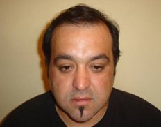 Slider image (8) Vita Hair | Clinica Capilar